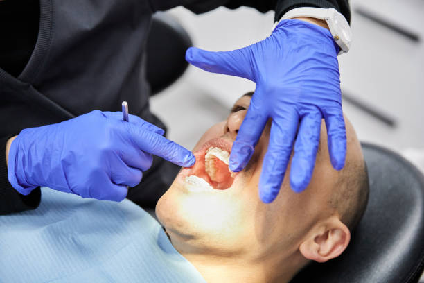 Best Teeth Whitening  in Massanutten, VA